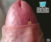 GAY STEPDAD - TINY PROBLEM - I NEVER THOUGHT I WOULD END UP TIGHTLY WRAPPED IN STEPDADS FORESKIN! - BY MANLYFOOT from daddy gay end son arabian xxx punjabi com
