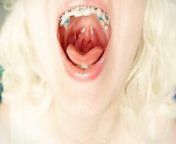 BRACES fetish - ASMR video of eating MUKBANG... food fetish. from chewed food