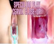 Stella St. Rose - Speculum Play, See My Cervix Close Up from speculumshow and touch my cervix close up