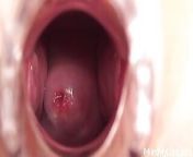 Young nurse gapes her pussy and shows her cervix through the speculum from russy
