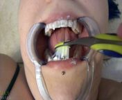 Dentist Probes Naughty Girl's Mouth from in dental clinic